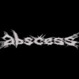 Abscess